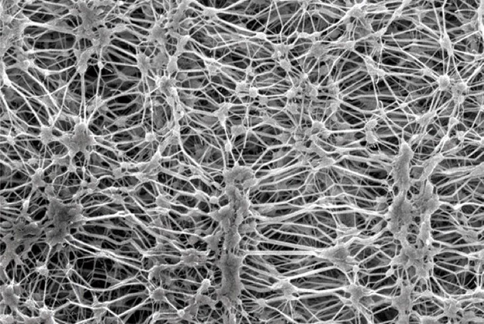 Qu'est-ce que la membrane PTFE